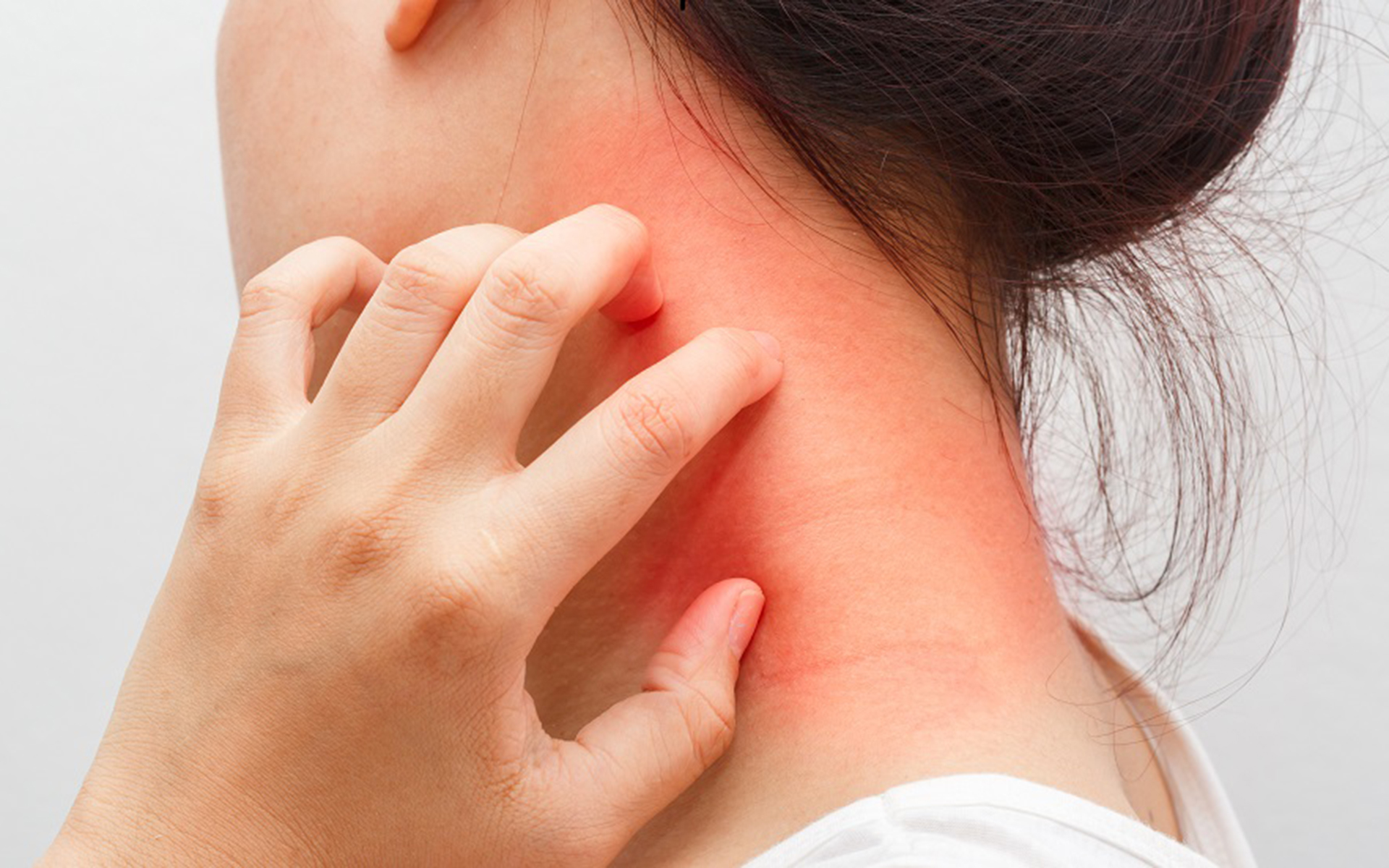 artrita dermatita cum să tratezi