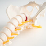 Vertebroplastia