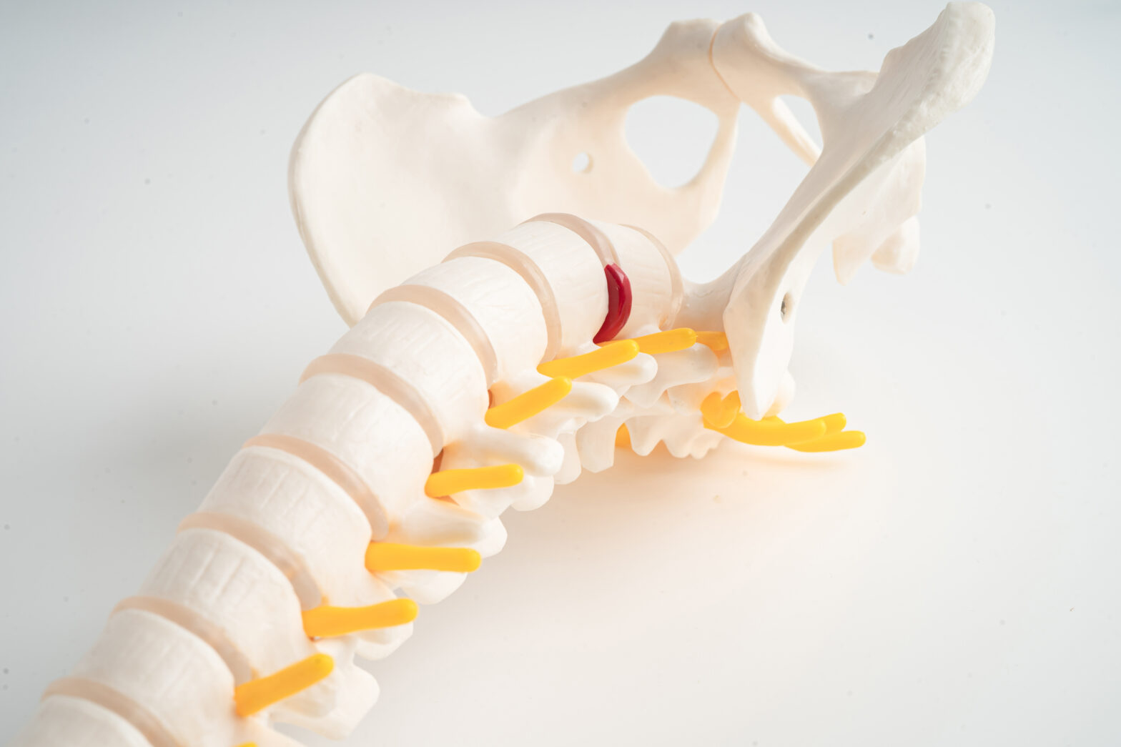 Vertebroplastia