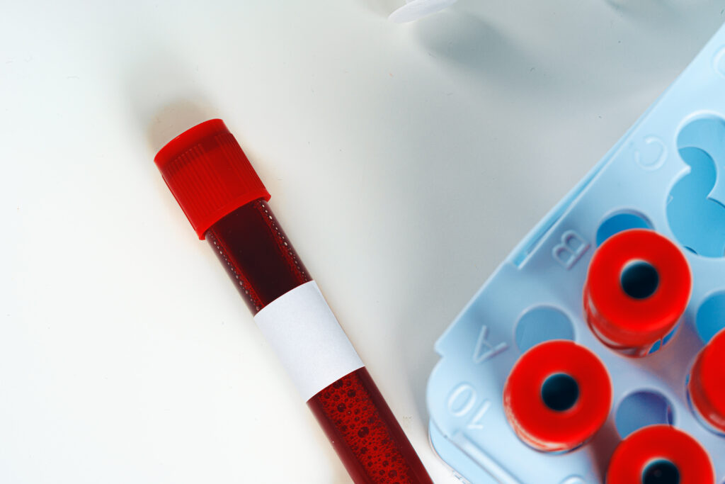 Teste de coagulare a sângelui: importanță, parametri și diagnostic