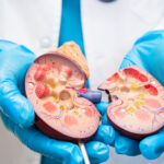 Pietrele la rinichi: de ce apar și cum le poți preveni eficient