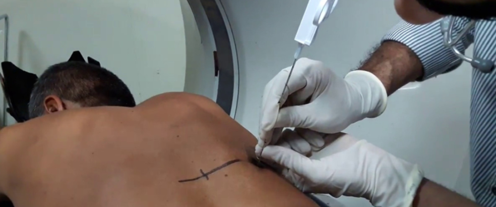Biopsia pulmonară: indicații, desfășurare, recuperare și riscuri