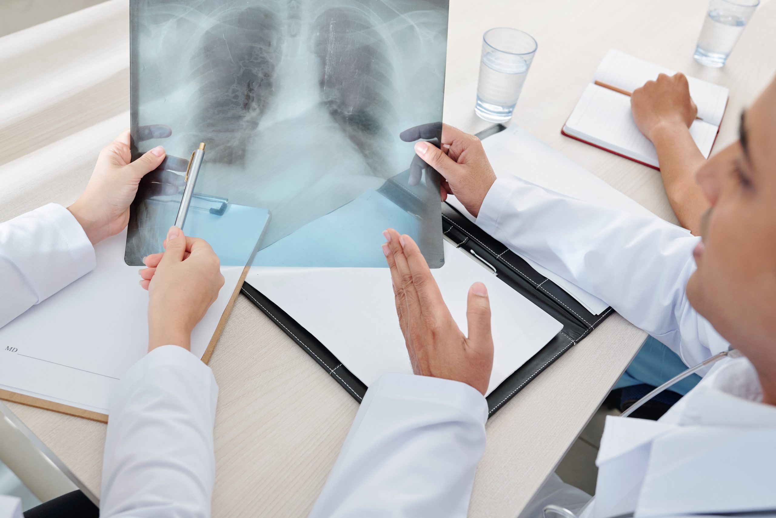 Tumor Board și planul terapeutic în cancerul pulmonar