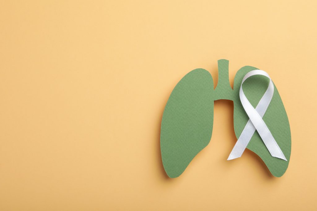 Opțiuni terapeutice actuale pentru cancerul pulmonar