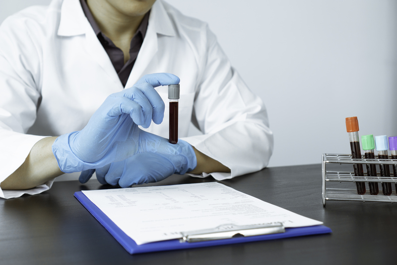 medic cu eprubeta cu sange in mana