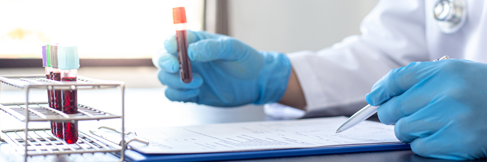 medic si epubete sange