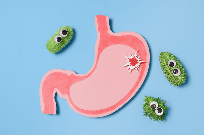 stomac cu gastrita si H. pylori